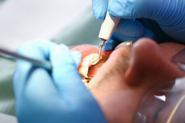Best Emergency Tooth Extraction  in Rogers City, MI