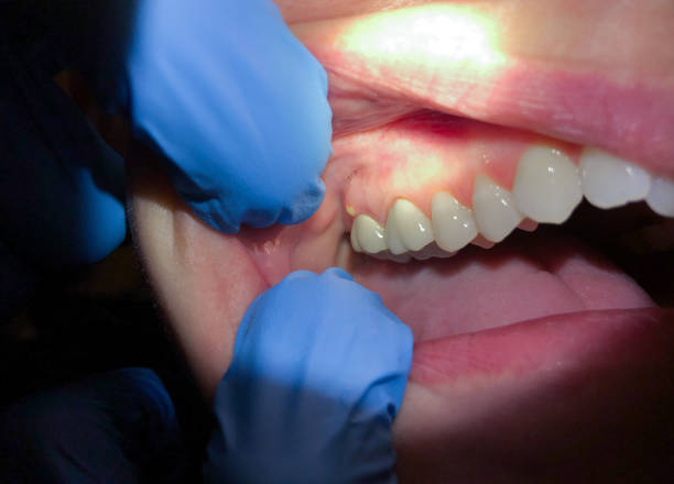 Best Chipped Tooth Repair Near Me  in Rogers City, MI