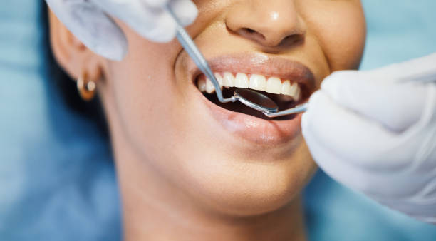 Best Teeth Whitening  in Rogers City, MI